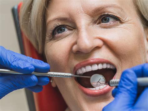 broken tooth west kelowna|Dentist West Kelowna .
